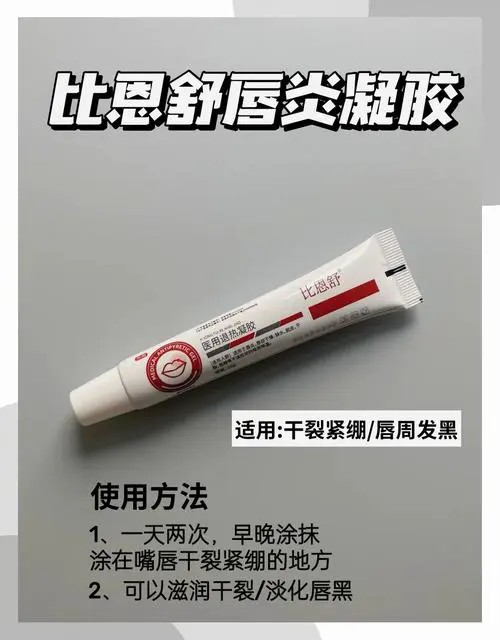 嘴唇干裂抹什么好