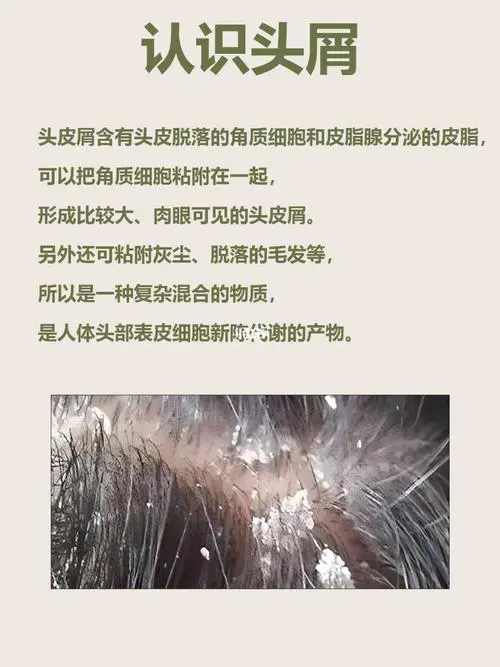 头皮干燥是什么原因