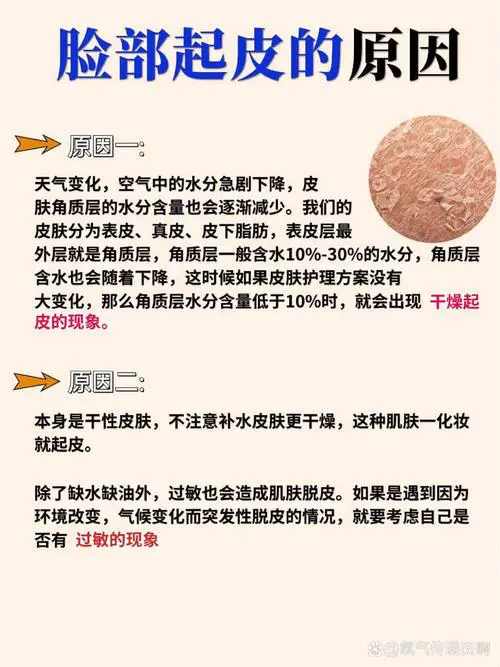 脸部起皮是什么原因