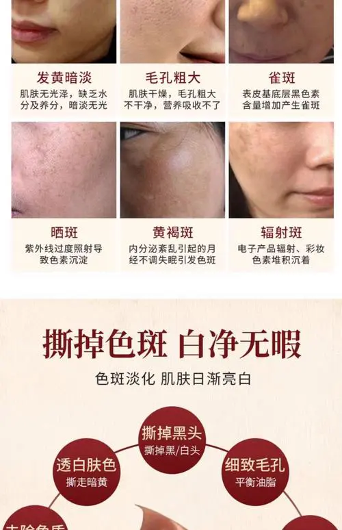 七天撕拉祛斑面膜怎么样