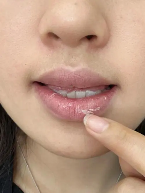 嘴唇很干是什么原因