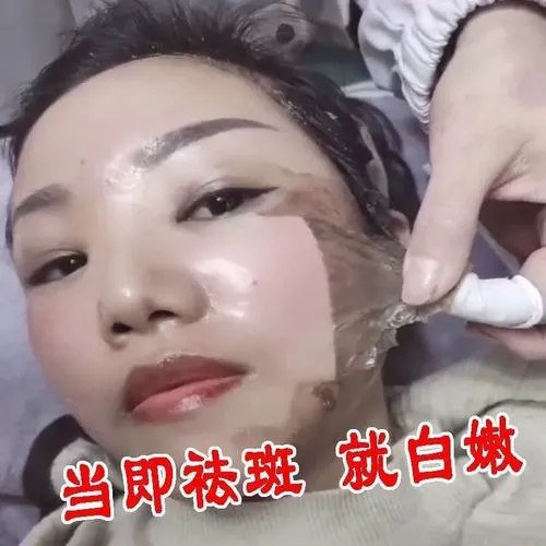 祛斑拉撕面膜怎么样