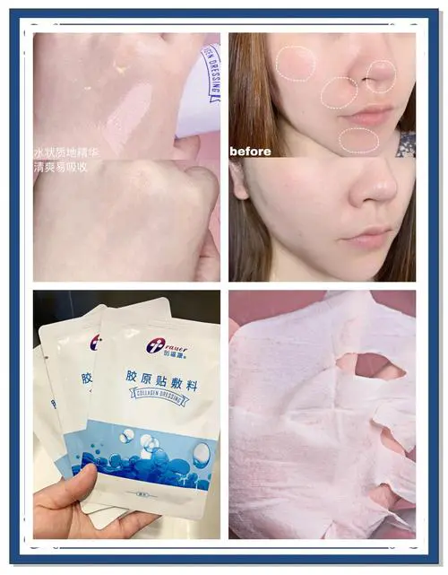 消红血丝的面膜怎么样