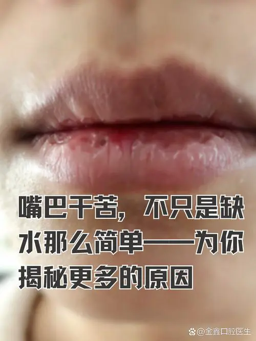 嘴唇很干是什么原因