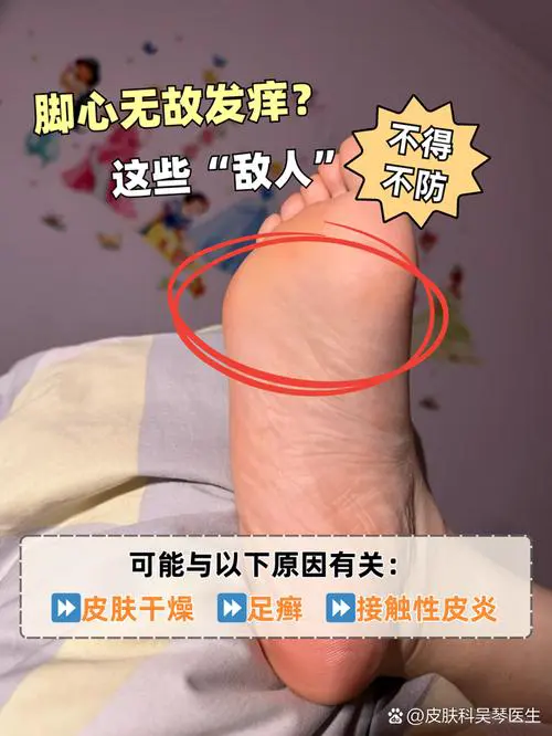 脚底干裂是什么原因