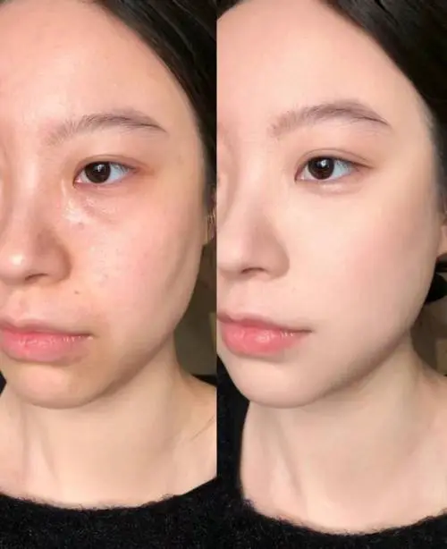 面膜混着用会怎么样