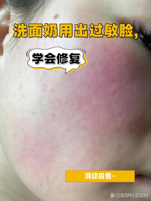 洗面奶变红是怎么回事