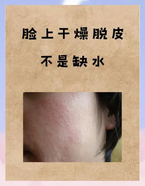 脸部起皮是什么原因