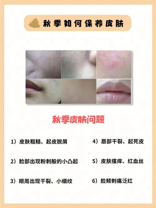 为什么秋天皮肤干燥