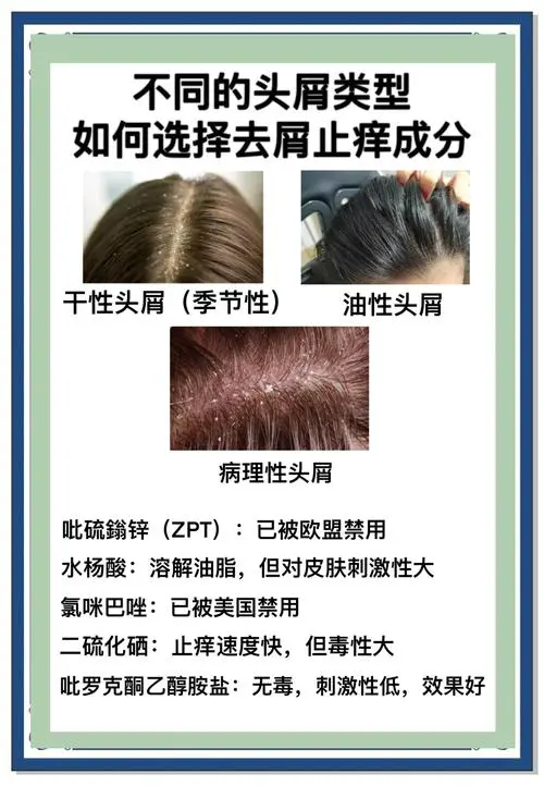 头皮干燥是什么原因