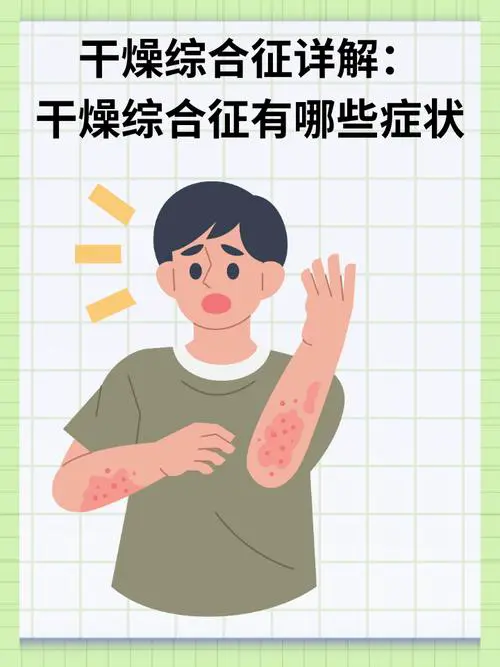 身体干燥是什么原因