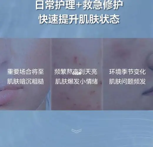 兰蔻小黑膜面膜怎么样