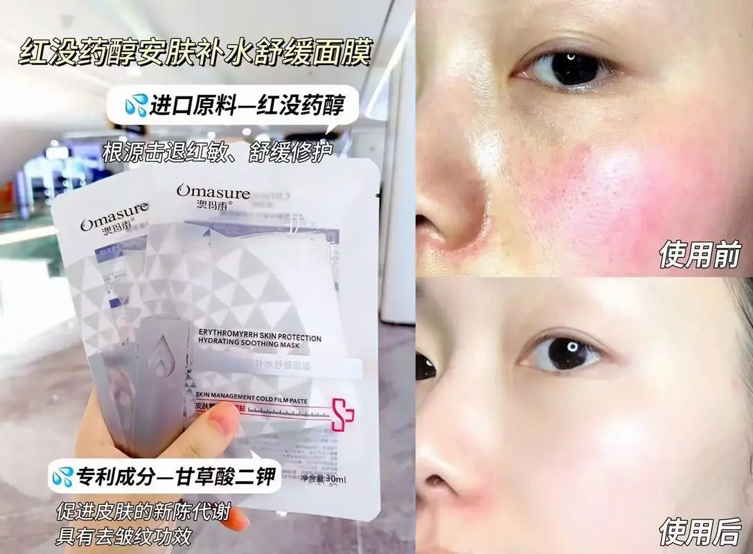 澳玛素面膜怎么样