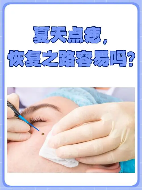 什么季节适合点痣