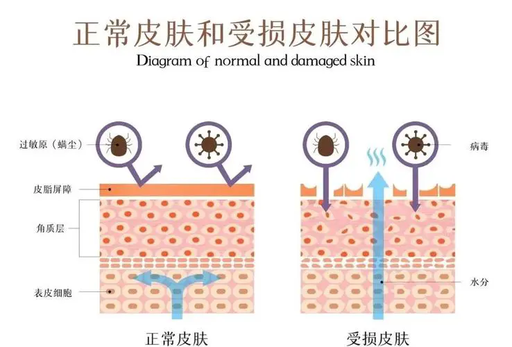 洗面奶洗脸后刺痛怎么办