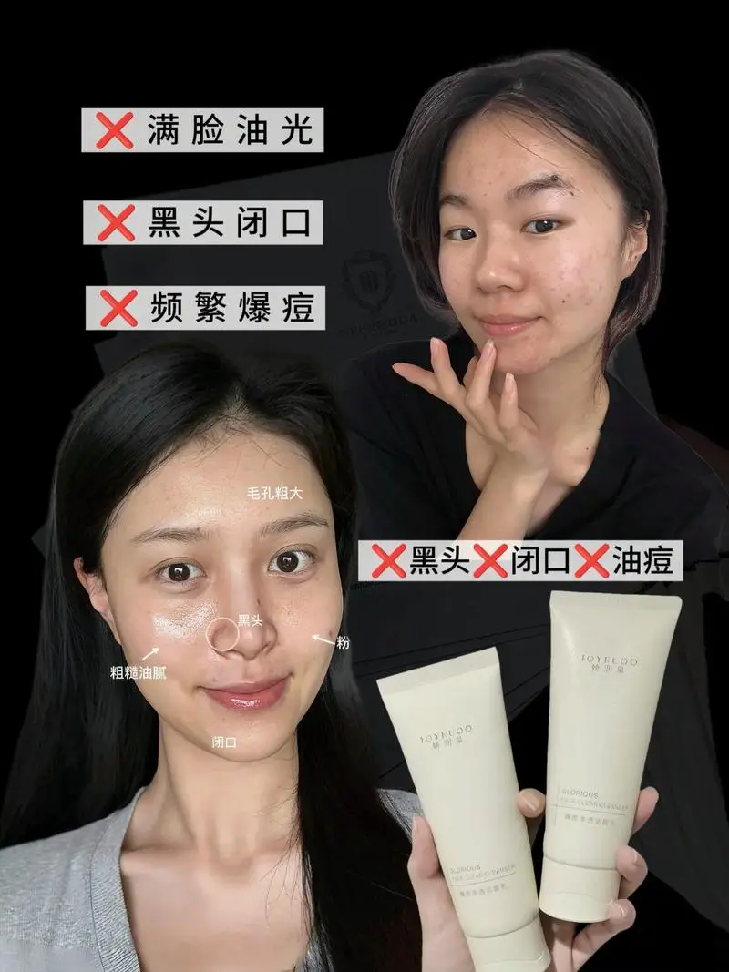 img水润氨基酸洗面奶怎么样