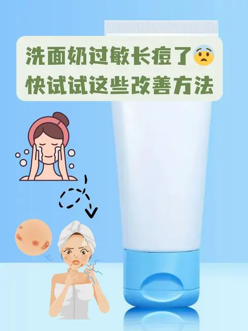 用洗面奶过敏后长痘痘怎么回事