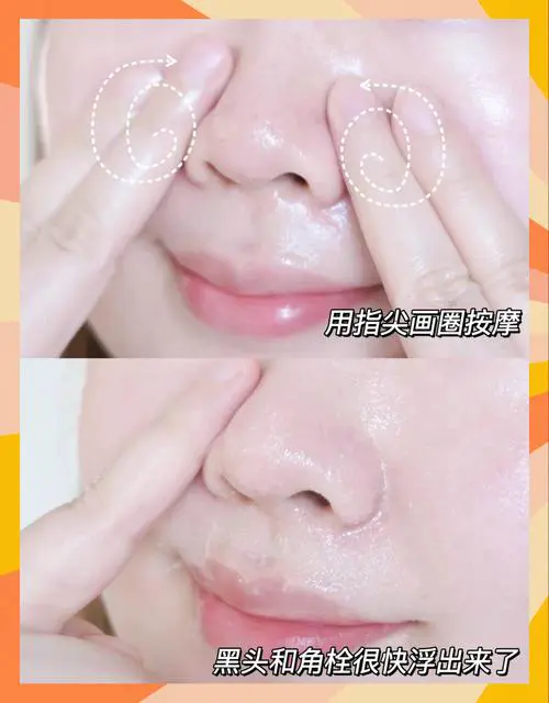 用洗面奶和卸妆水怎么清洁黑头