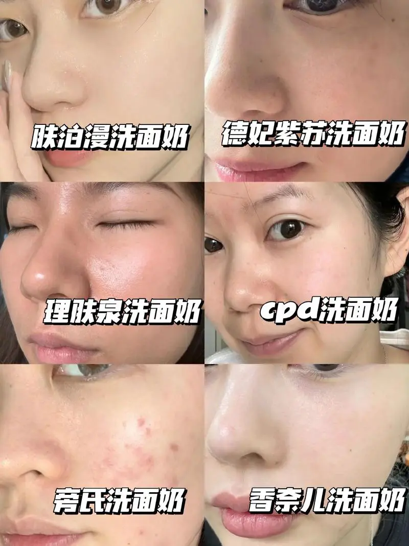 洗面奶不洗会怎么样