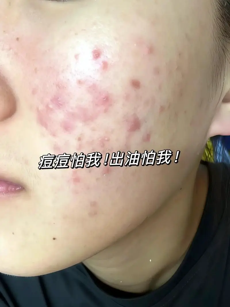 误食洗面奶怎么办