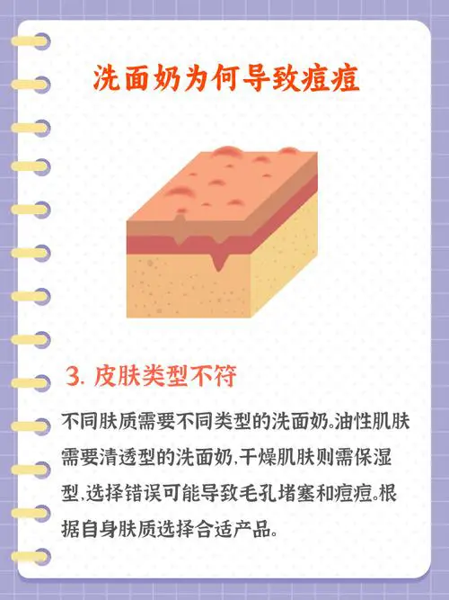 洗洗面奶长痘了怎么办
