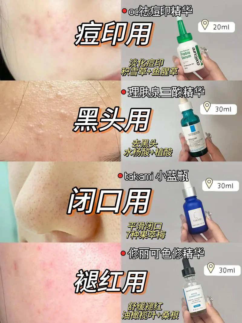 豆印豆坑怎么洗面奶