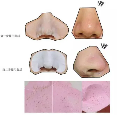 holika猪鼻子洗面奶怎么样