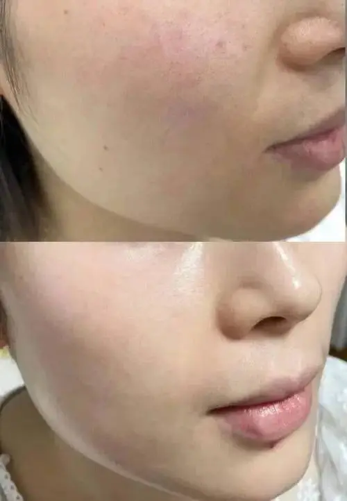 用洗面奶后脸怎么感觉有些地方紧紧的?