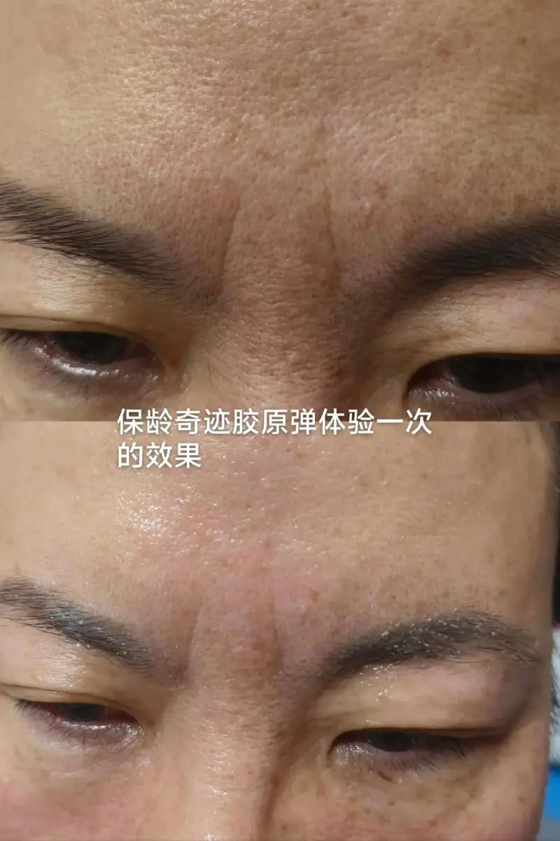 保龄奇迹护肤品最新评价