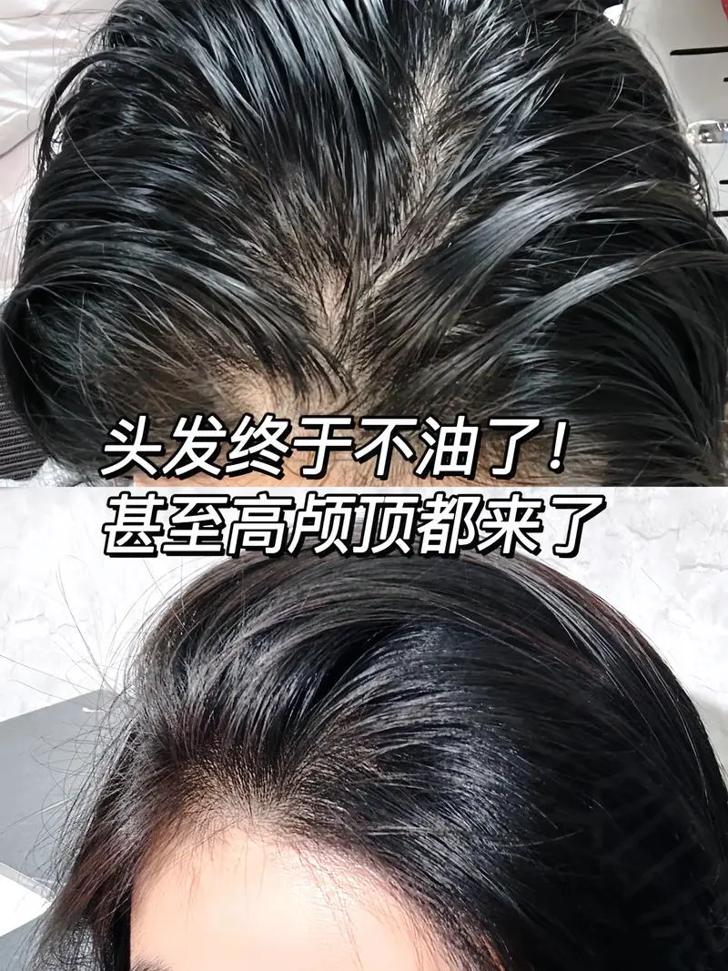 卡诗洗发水最新包装