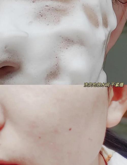 洗面奶把身上不洗掉会怎么样