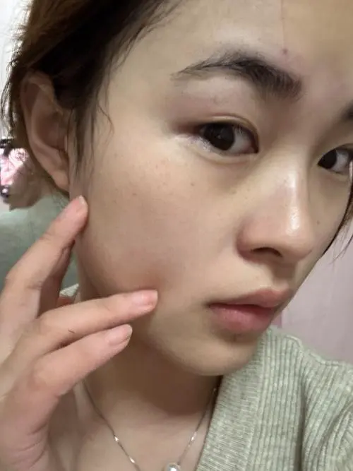 用洗面奶后脸怎么感觉有些地方紧紧的?