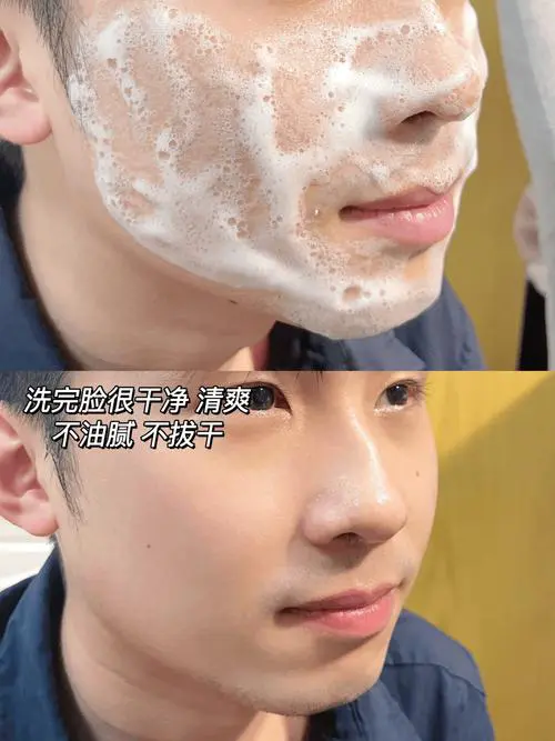 男士用洗面奶洗脸的时候把头发弄湿了怎么办