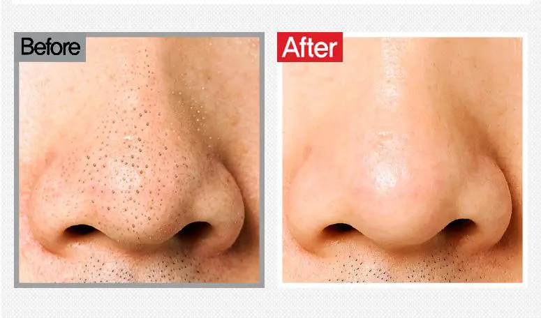 holika猪鼻子洗面奶怎么样