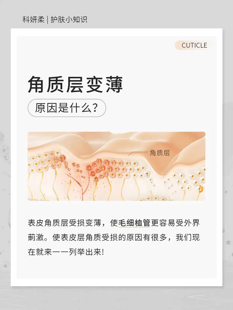 什么是角质层薄