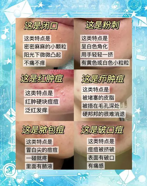 下巴长痘代表什么