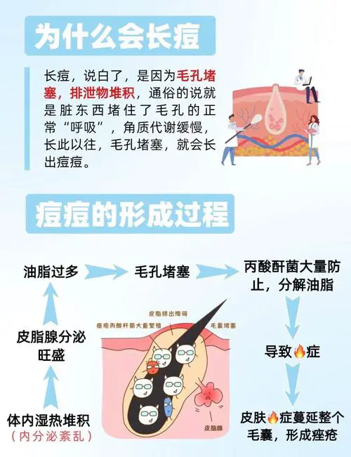 为什么会生痘痘