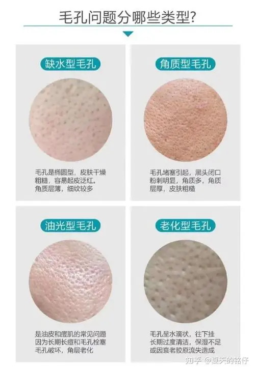 毛孔变大是什么原因