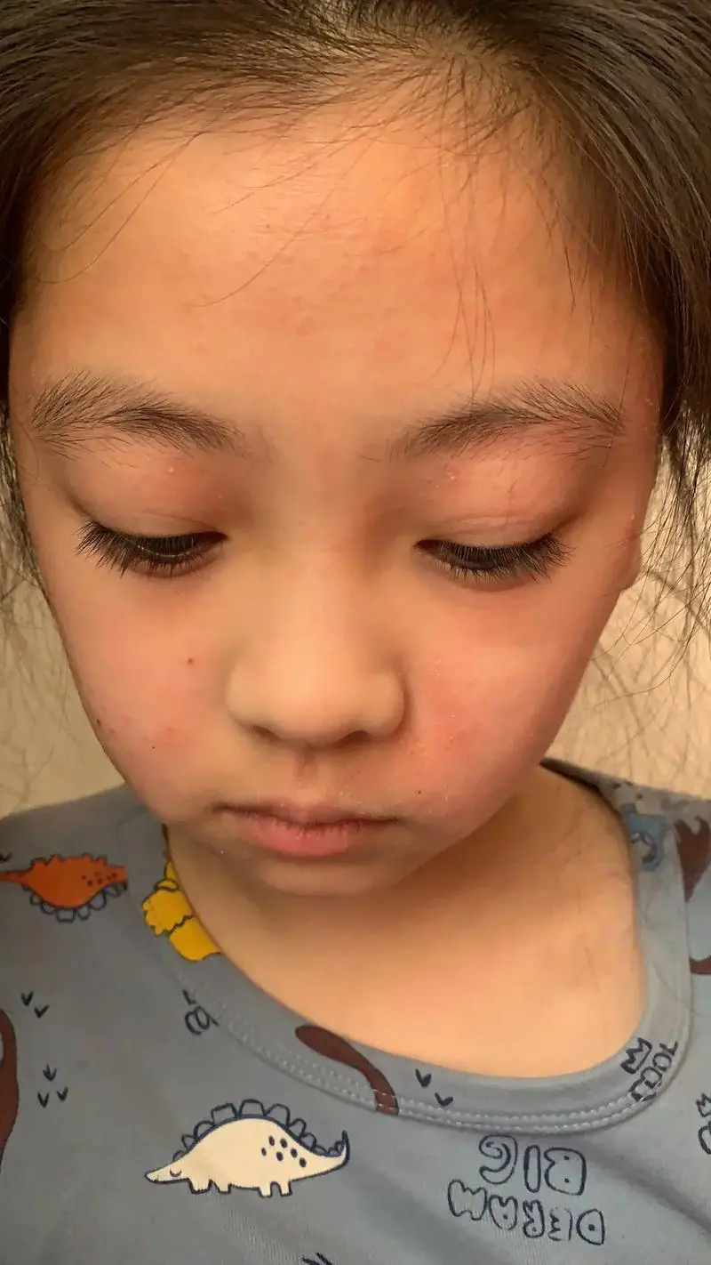 脸为什么经常过敏