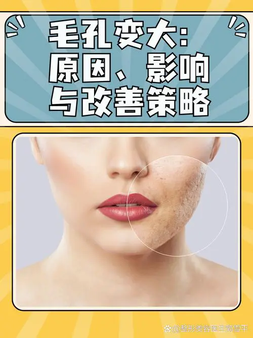 毛孔变大是什么原因