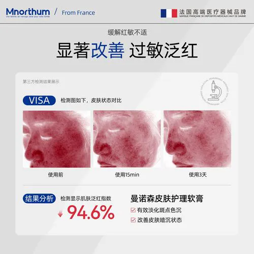 皮肤敏感用什么护肤品