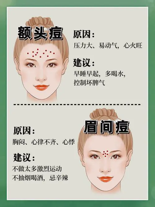 满脸痘痘是什么原因