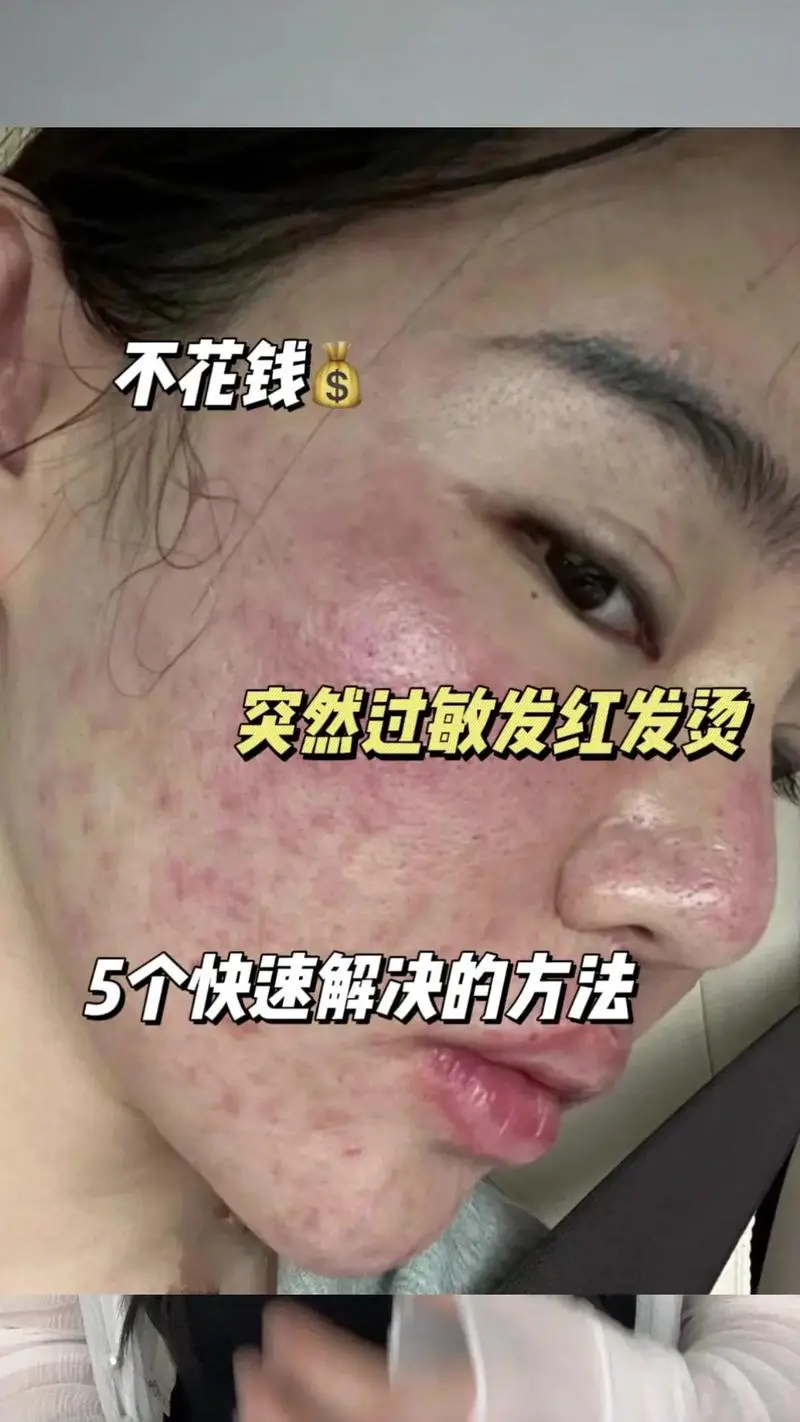 脸为什么经常过敏