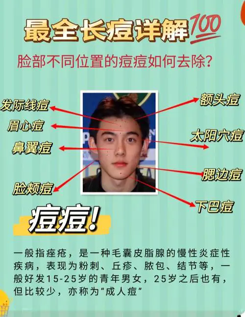 男的长痘痘什么原因