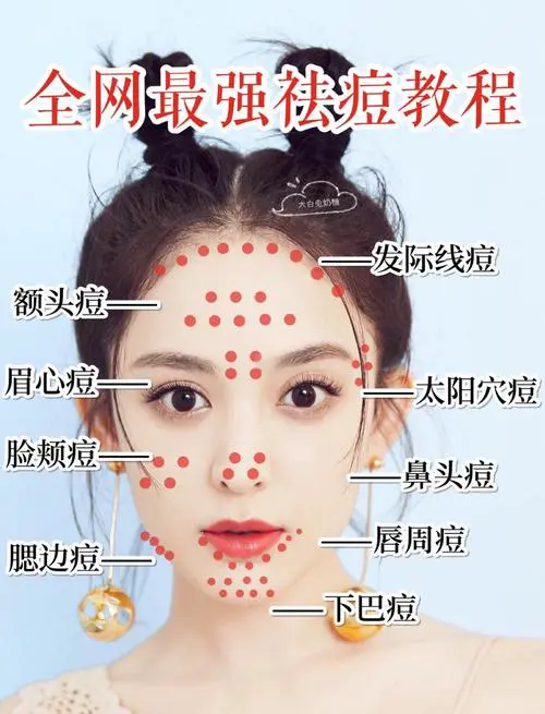 满脸痘痘是什么原因