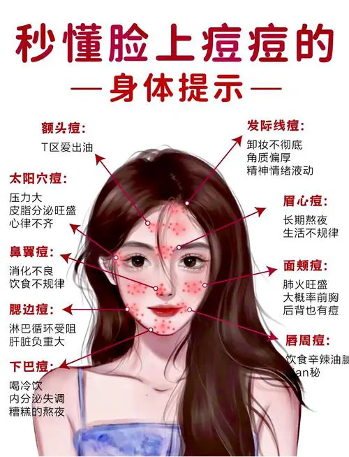 为什么会生痘痘