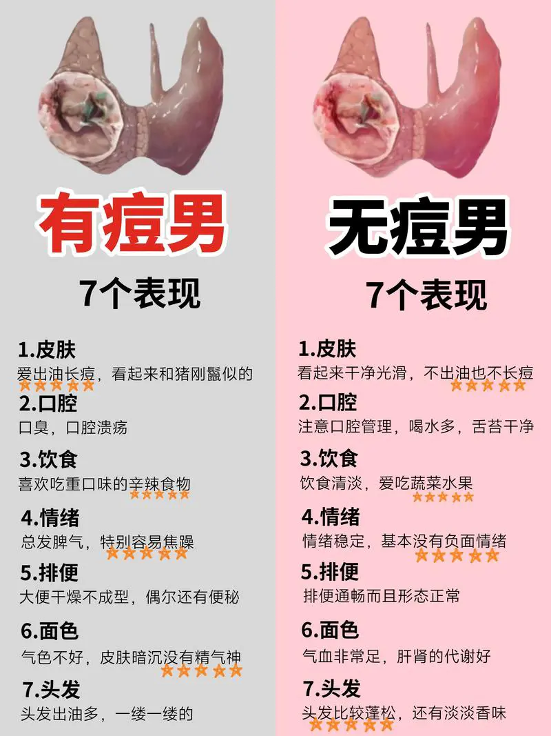 男的长痘痘什么原因