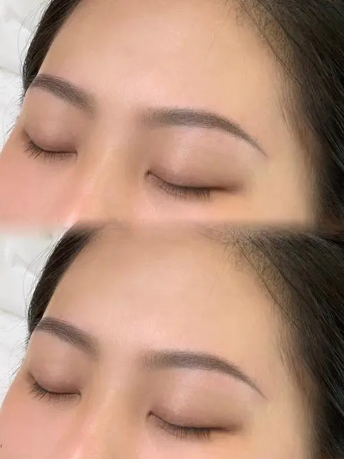 眉毛为什么越来越少