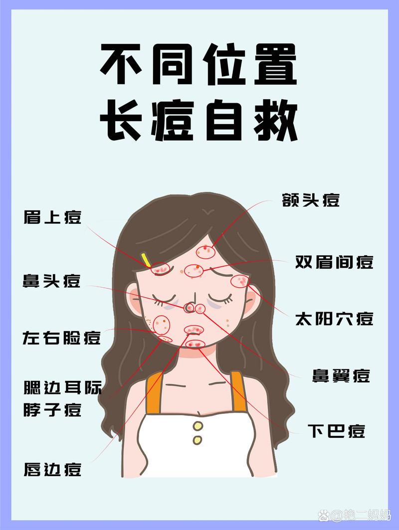 长期长痘痘是什么原因