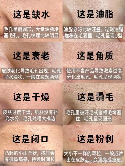 脸上为什么有毛孔